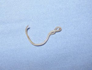 Roundworm
